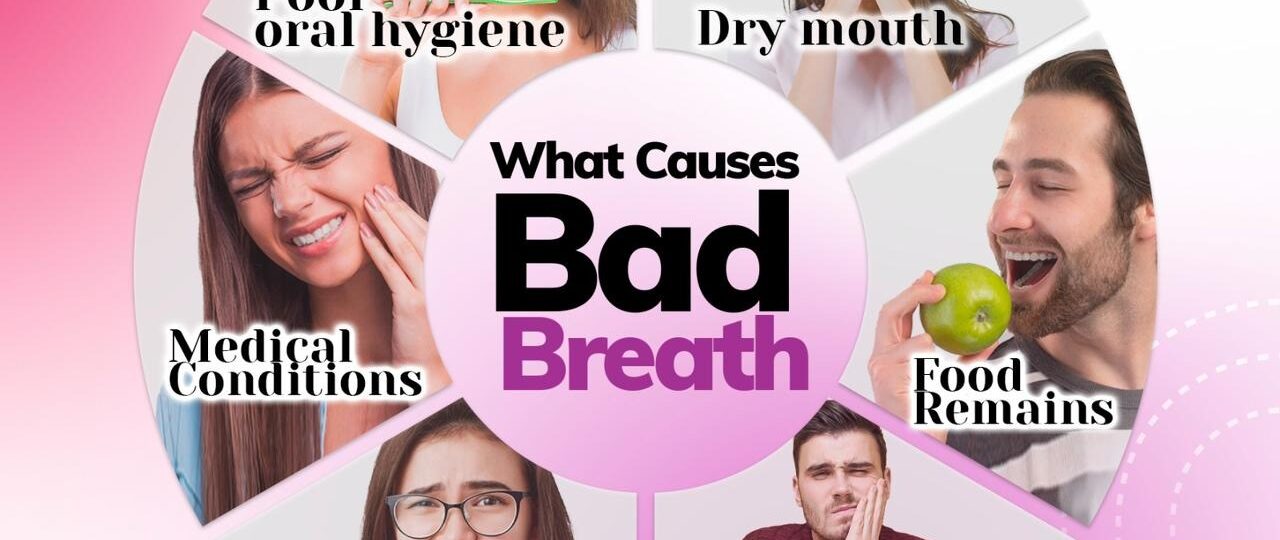 Bad breath, or halitosis, is commonly caused by poor oral hygiene, certain foods, dry mouth, smoking, or medical conditions.