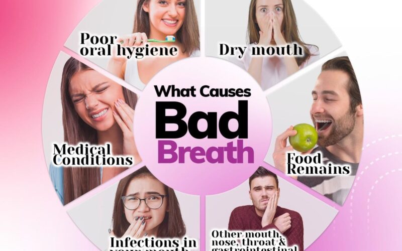 Bad breath, or halitosis, is commonly caused by poor oral hygiene, certain foods, dry mouth, smoking, or medical conditions.