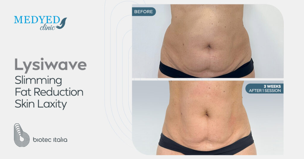 عيادة Medyed تجربة شاملة للعلاجات التجميلية والعافية المتقدمة عيادة Medyed تجربة شاملة للعلاجات التجميلية والعافية المتقدمة