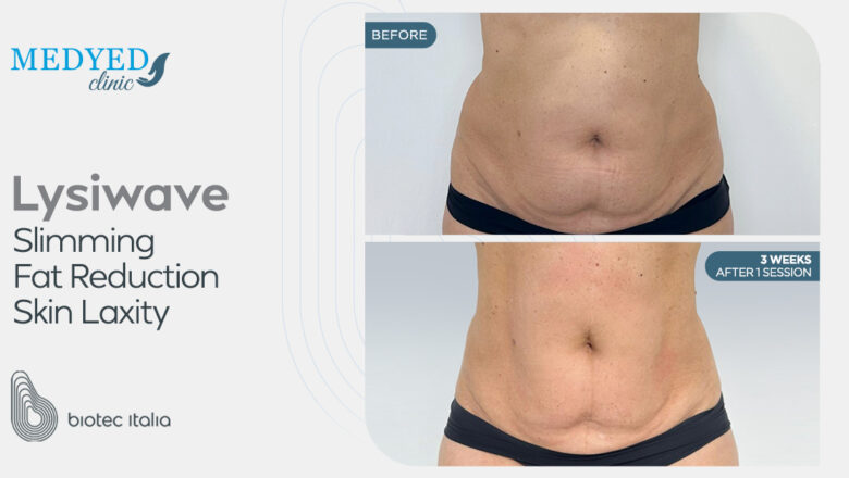 عيادة Medyed تجربة شاملة للعلاجات التجميلية والعافية المتقدمة